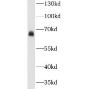 WB analysis of HeLa cells, using CA9 antibody (1/500 dilution).