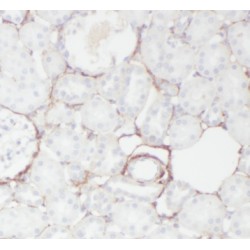 Carbonic Anhydrase 9 (CA IX) Antibody