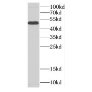 WB analysis of mouse brain tissue, using CA IX antibody (1/300 dilution).