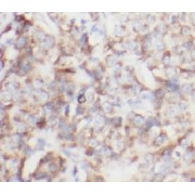 WB analysis of Jurkat cells, using CA1 antibody (1/500 dilution).