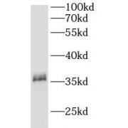 WB analysis of human kidney tissue, using CA11 antibody (1/400 dilution).