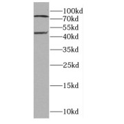 WB analysis of BxPC-3 cells, using CA12 antibody (1/300 dilution).