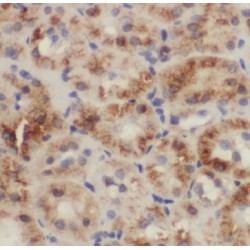 Carbonic Anhydrase 7 (CA7) Antibody