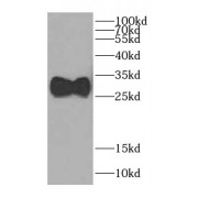 WB analysis of human kidney tissue, using CA7 antibody (1/400 dilution).