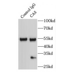 Carbonic Anhydrase-Related Protein (CA8) Antibody