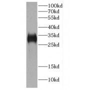 WB analysis of mouse skeletal muscle tissue, using CA8 antibody (1/500 dilution).