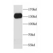 WB analysis of human kidney tissue, using CDH16 antibody (1/400 dilution).