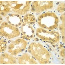 Calcium-Binding And Coiled-Coil Domain-Containing Protein 1 (CALCOCO1) Antibody