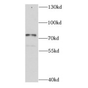 WB analysis of HT-1080 cells, using CALCOCO1 antibody (1/1000 dilution).