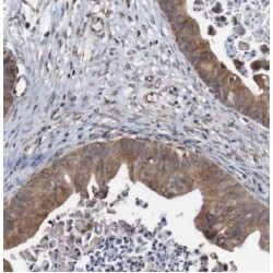 Calcium-Binding And Coiled-Coil Domain-Containing Protein 2 (CALCOCO2) Antibody