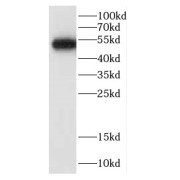 WB analysis of HeLa cells, using CALCOCO2 antibody (1/1000 dilution).