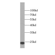 WB analysis of human spleen tissue, using Calcyphosine antibody (1/500 dilution).