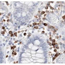 Caldesmon (CALD1) Antibody