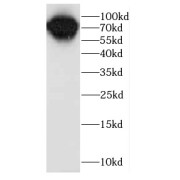 WB analysis of mouse small intestine tissue, using CALD1 antibody (1/500 dilution).