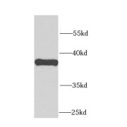 WB analysis of mouse brain tissue, using CALHM1 antibody (1/1000 dilution).