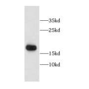 Western blot analysis of A431 cells using CALML3 antibody (1/300 dilution).