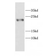 WB analysis of human colon tissue, using CALML4 antibody (1/300 dilution).