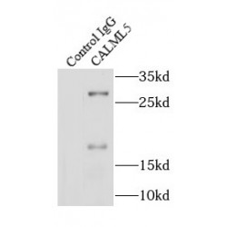 Calmodulin-Like Protein 5 (CALML5) Antibody