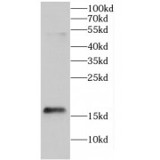 WB analysis of A431 cells, using CALML5 antibody (1/400 dilution).