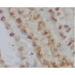 Calmodulin-Like Protein 6 (CALML6) Antibody