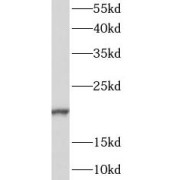 WB analysis of human heart tissue, using CALML6 antibody (1/500 dilution).