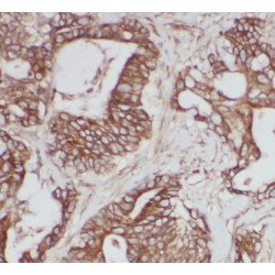 Calpain 2 (CAPN2) Antibody