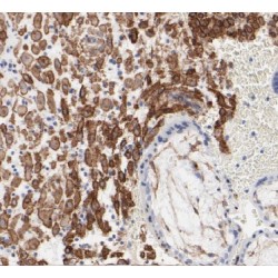 Calpain 6 (CAPN6) Antibody