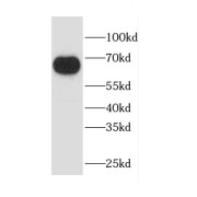 WB analysis of human placenta tissue, using CAPN6 antibody (1/300 dilution).