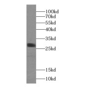 WB analysis of mouse skin tissue, using Calpain S2 antibody (1/300 dilution).