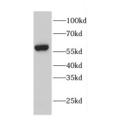 WB analysis of NIH/3T3 cells, using calreticulin antibody (1/600 dilution).