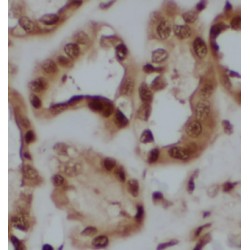 Calretinin (CALB2) Antibody