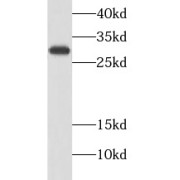 WB analysis of SW480 cells, using calretinin antibody (1/1000 dilution).