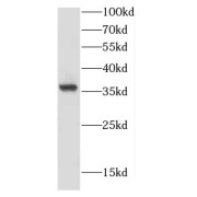 WB analysis of Jurkat cells, using CAMLG antibody (1/1000 dilution).