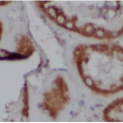 Calmodulin Regulated Spectrin Associated Protein 1-Like 1 (CAMSAP1L1) Antibody