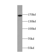 WB analysis of mouse brain tissue, using CAMSAP1L1 antibody (1/500 dilution).