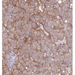 Adenylyl Cyclase Associated Protein 2 (CAP2) Antibody