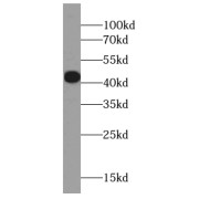 WB analysis of mouse lung tissue, using CAPG-Specific antibody (1/300 dilution).