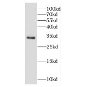 WB analysis of human brain tissue, using CAPZA1 antibody (1/400 dilution).