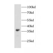 WB analysis of mouse brain tissue, using CAPZA2 antibody (1/1000 dilution).