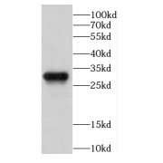 WB analysis of HeLa cells, using CAPZB antibody (1/3000 dilution).