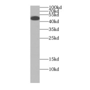 WB analysis of PC-3 cells, using Carboxypeptidase A5 antibody (1/500 dilution).