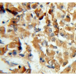 Carboxypeptidase E (CPE) Antibody