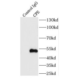 Carboxypeptidase E (CPE) Antibody