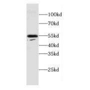 WB analysis of mouse brain tissue, using CPE antibody (1/600 dilution).