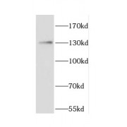 WB analysis of HepG2 cells, using CARD6 antibody (1/400 dilution).