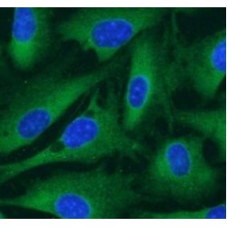 Coactivator-Associated Arginine Methyltransferase 1 (CARM1) Antibody