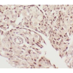 Coactivator-Associated Arginine Methyltransferase 1 (CARM1) Antibody