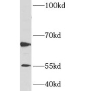 WB analysis of NIH/3T cells, using CARM1 antibody (1/500 dilution).