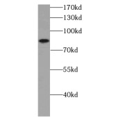 WB analysis of HeLa cells, using CARNS1 antibody (1/300 dilution).