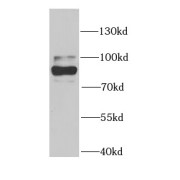 WB analysis of HeLa cells, using CARS antibody (1/1500 dilution).